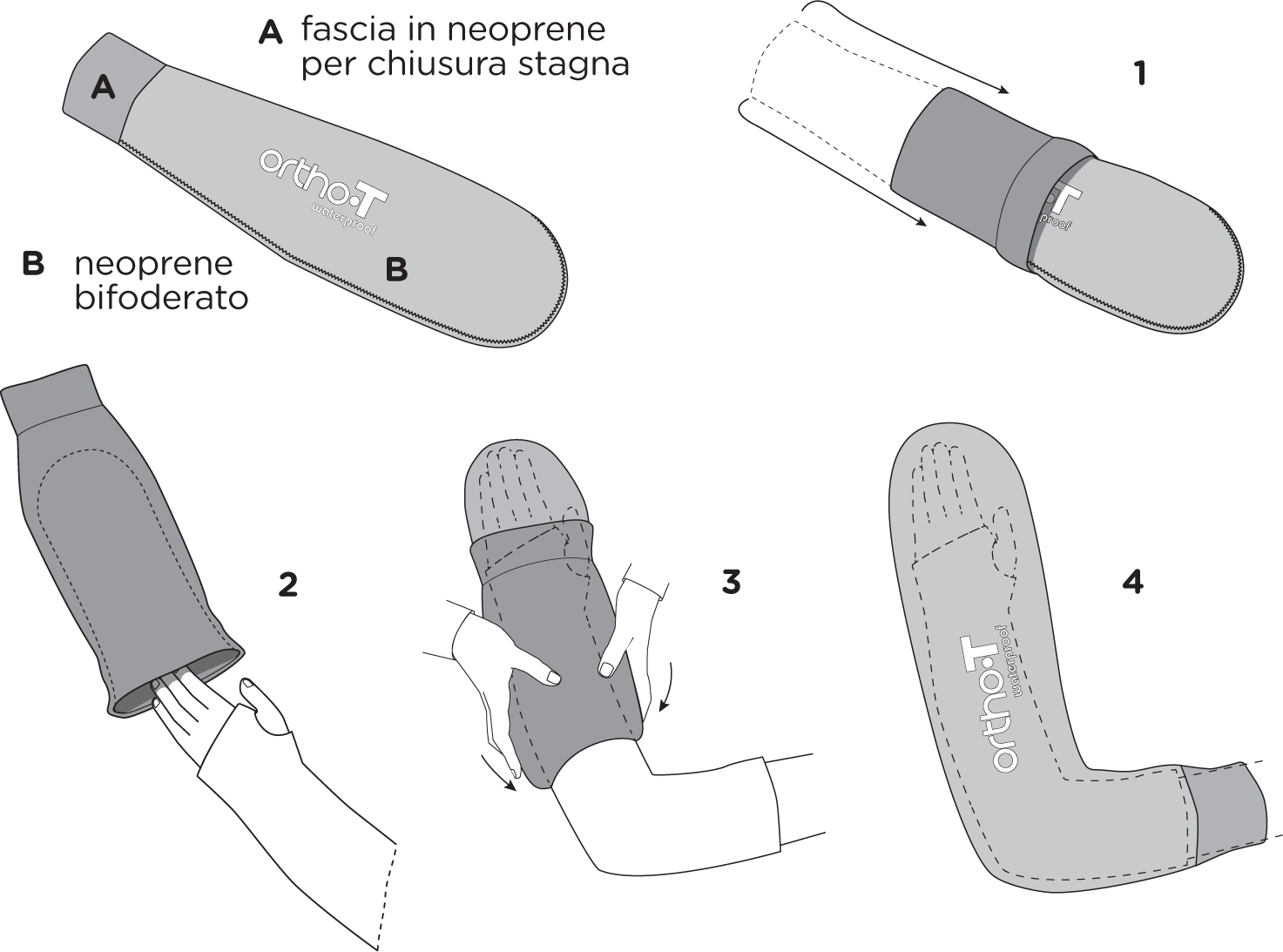 Schema If-Ortho Braccio